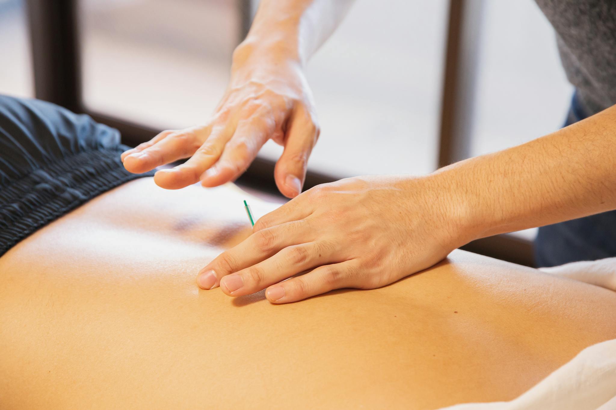 Acupuncturist working and healing the back of a patient