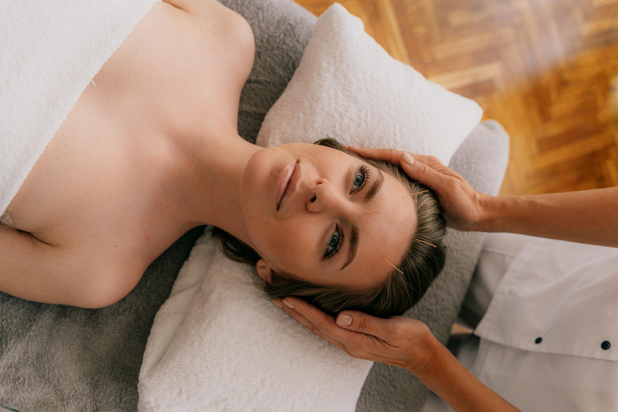 Woman receiving acupuncture therapy in a serene, indoor setting for wellness enhancement.